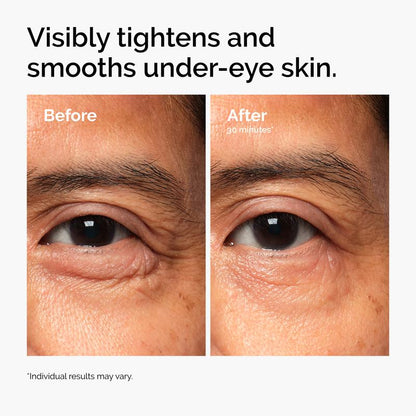 5-Minute Eye Lift Cream
