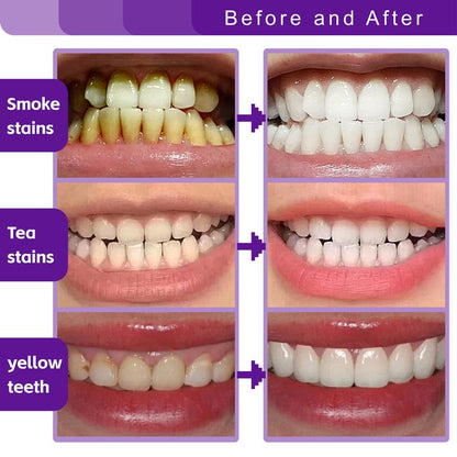 korvital™ Purple Correct