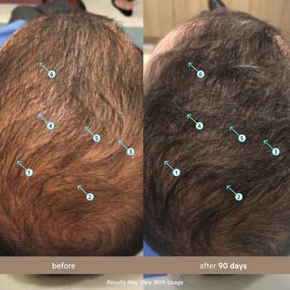 VIRODENSE — Sérum de Densidad para Barba y Cabello