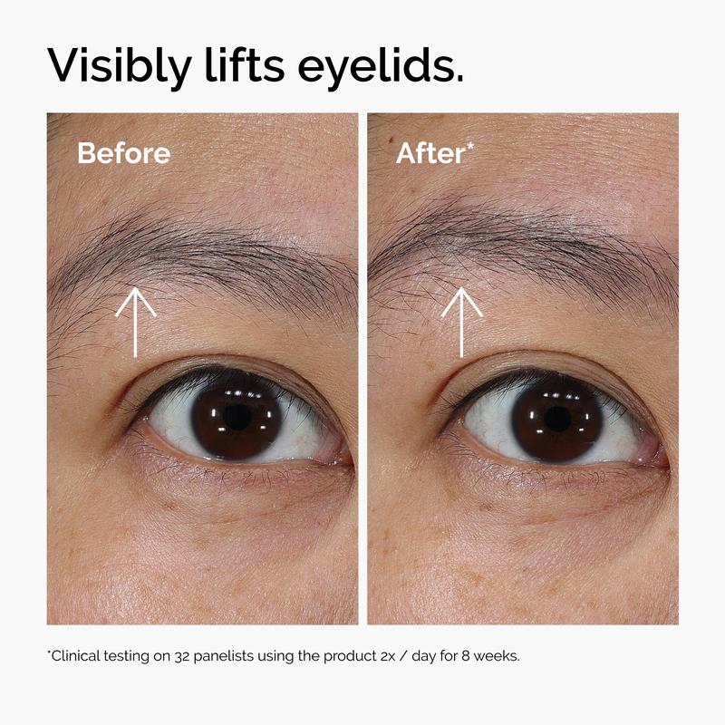 5-Minute Eye Lift Cream