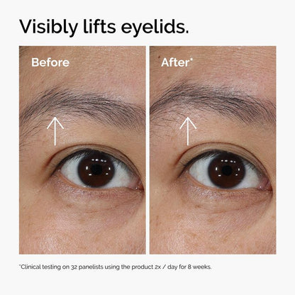 5-Minute Eye Lift Cream