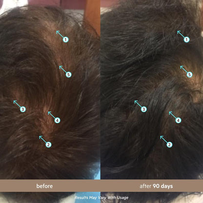 VIRODENSE — Sérum de Densidad para Barba y Cabello