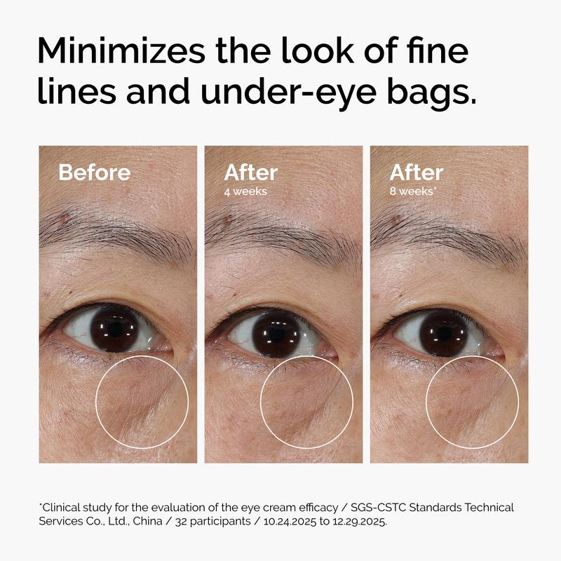 5-Minute Eye Lift Cream